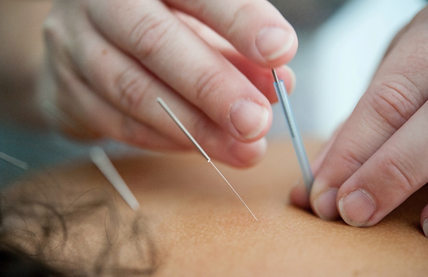 How effective is acupuncture for chronic back pain